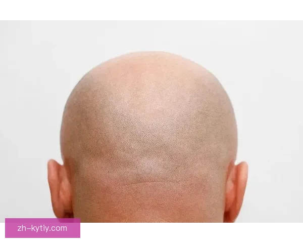 剃光头的背后理由大揭秘